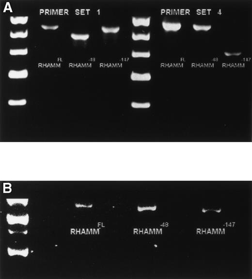 Fig. 4. Identification of ORF RHAMM isoforms from MM plasma cells. (A) Plasma cell ORF RHAMM was amplified, cloned, and colonies screened by PCR with primer set 1 and primer set 4. The amplification products from cloned RHAMMFL were 613 bp (lane 2) and 666 bp (lane 6), from RHAMM−48 were 565 bp (lane 3) and 666 bp (lane 7), and from RHAMM−147 were 613 bp (lane 4) and 519 bp (lane 8). Markers (lane 1 and 5) are 700, 600, 500, 400, and 300 bp. (B) A representative clone of each ORF RHAMM isoform was restriction-digested from the PCR TM II vector with EcoRV plusKpn I and sized on a 1% agarose gel. RHAMMFLis 2.319 kb; RHAMM−48 is 2.268 kb; and RHAMM−147 is 2.172 kb. Markers are 2.5, 2, 1.5, and 1 kb.