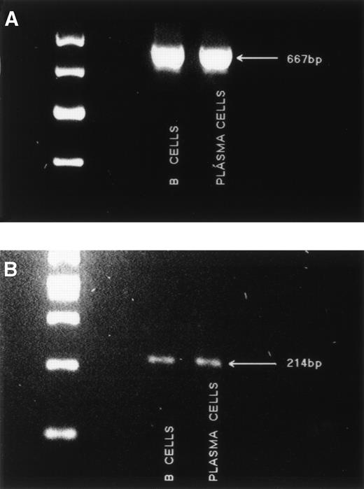 Fig. 5. Amplification of exon 4 and the “repeat” region from MM B cells and plasma cells. (A) The region spanning exon 4 was amplified from MM B cells and plasma cells with primer set 6. A single band of 667 bp was detected. Markers are 700, 600, 500, and 400 bp. (B) The “repeat” region of RHAMM was amplified from MM B cells and plasma cells with primer set 7. A single band of 214 bp was detected. Markers are 500, 400, 300, 200, and 100 bp.