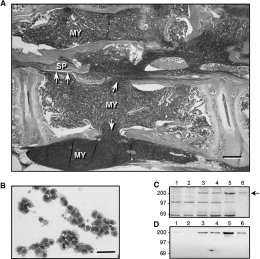 Fig. 1. Characterization of 5TGM1 myeloma cells. (A) Hematoxylin and eosin (H&E) stained section of a lumbar vertebra from the 5TGM1 founder animal, showing myeloma cells (MY), which have almost completely replaced the normal bone marrow and are associated with osteolysis. Note that trabecular bone is absent from the growth plate shown at left and greatly reduced in the growth plate shown at right. Arrowheads indicate areas where cortical bone has been destroyed, allowing tumor cells to invade the surrounding tissue. This animal was paraplegic at the time of death and in this section, the spinal cord (SP) can be seen to be surrounded by myeloma cells, which has resulted in spinal compression (bar = 200 μm). (B) Giemsa stained cytocentrifuge preparation of cultured 5TGM1 myeloma cells, exhibiting a characteristic myeloma morphology (bar = 100 μm). (C) Coomassie blue-stained SDS-PAGE analysis of serum from control mice (lanes 1, 2), 5TGM1 myeloma-bearing mice (lanes 3, 4), and the 5TGM1 founder animal (lane 5), lane 6 shows 1 μg of IgG2b standard for comparison. The arrow indicates the IgG2b band. (D) Identical gel to C, which was analyzed by Western blotting using antibodies against mouse IgG2b. Lanes 1 through 6 are the same as for C.