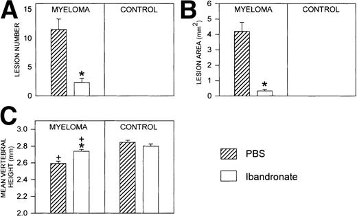 Fig. 3. Histograms showing (A) the number and (B) the area of osteolytic lesions in the lumbar vertebrae of 5TGM1 myeloma-bearing and control mice with and without ibandronate treatment (4 μg per mouse per day for 28 days). Lesions were quantified by computerized image analysis from radiographs taken at sacrifice. Data are mean ± SEM (n = 6). ∗, Significant reduction compared with myeloma + PBS. (C) Histogram showing the effect of ibandronate treatment (4 μg per mouse per day for 28 days) on the mean height of the lumbar vertebrae in 5TGM1 myeloma-bearing and control mice. The height of each lumbar vertebra was measured by image analysis from radiographs taken at sacrifice and the mean vertebral height calculated for each animal. Data are mean ± SEM (n = 6). +, Significant decrease compared with PBS treated non–tumor-bearing control. ∗, Significant increase compared with myeloma + PBS.