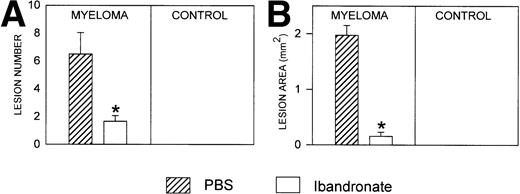 Fig. 4. Histograms showing (A) the number and (B) the area of osteolytic lesions in the long bones of 5TGM1 myeloma-bearing and control mice with and without ibandronate treatment. Lesions were quantified by computerized image analysis from radiographs taken at death. Data are mean ± SEM (n = 6). ∗, Significant reduction compared with myeloma + PBS.