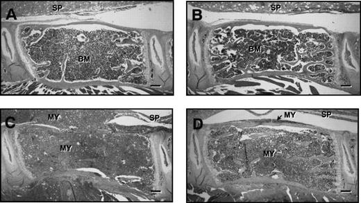 Fig. 5. H & E stained sections of lumbar vertebrae from control and 5TGM1 myeloma-bearing mice treated with PBS or ibandronate (4 μg per mouse per day for 28 days). (A) Non–tumor-bearing control treated with PBS, (B) non–tumor-bearing control treated with ibandronate, (C) 5TGM1 myeloma-bearing mouse treated with PBS, (D) 5TGM1 myeloma-bearing mouse treated with ibandronate. The spinal cord (SP) is indicated in each figure. Note that in the non–tumor-bearing animals, (A) and (B), the marrow cavity is filled with normal marrow (BM). In contrast in myeloma-bearing animals (C) and (D), the normal bone marrow has been replaced by myeloma cells (MY), which have also invaded the surrounding tissues. In the myeloma-bearing animal treated with PBS (C), there is a clear loss of trabecular bone and also some loss of cortical bone. This bone loss is prevented by ibandronate treatment (D). Bar = 200 μm.