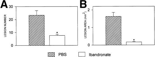 Fig. 8. Histograms showing (A) the number and (B) the area of osteolytic lesions in the long bones of 5T33 myeloma-bearing mice with and without ibandronate treatment. Lesions were quantified by computerized image analysis from radiographs taken at death. Data are mean ± SEM (n = 6). ∗, Significant reduction compared with myeloma + PBS.
