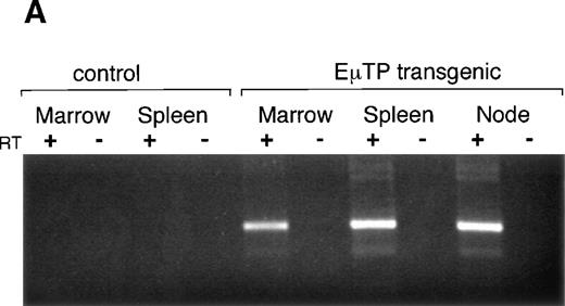 Fig. 4. Assessment of TEL/PDGFβR transgene expression: the fusion protein is expressed in tumors and hematopoietic tissues from transgenic mice, but not in tissues from normal controls. (A) PCR of RNA isolated from transgenic and normal mouse tissues. The forward primer (TPY3F, 5′-TAC AAA AAG TAC CAG CAG-3′) binds the 3′ end of the PDGFβR, and the reverse primer (HBG1, 5′-GCG AGC TTA GTG ATA CTT GT-3′) anneals to the antisense strand of the human β-globin exon 3 and were designed to span the β-globin intron in the transgenic construct (see Fig 2). Samples contaminated with genomic DNA give a larger, 1.6-kb product (data not shown). The 0.7-kb product expected from the amplification of spliced mRNA is seen in samples isolated from transgenic mouse tumor, spleen, and bone marrow, but not in normal spleen, bone marrow, or in reverse transcriptase–negative controls. (B) Western blot of whole-cell lysates from tumors (N), bone marrow (M), and kidney (K). The antibody used was tail PDGFβR. The TEL/PDGFβR protein runs as a doublet, as reported previously,10 due to an alternate start site for translation within the TEL gene.