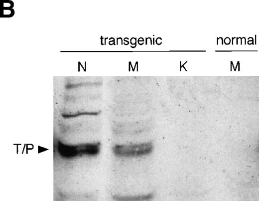 Fig. 4. Assessment of TEL/PDGFβR transgene expression: the fusion protein is expressed in tumors and hematopoietic tissues from transgenic mice, but not in tissues from normal controls. (A) PCR of RNA isolated from transgenic and normal mouse tissues. The forward primer (TPY3F, 5′-TAC AAA AAG TAC CAG CAG-3′) binds the 3′ end of the PDGFβR, and the reverse primer (HBG1, 5′-GCG AGC TTA GTG ATA CTT GT-3′) anneals to the antisense strand of the human β-globin exon 3 and were designed to span the β-globin intron in the transgenic construct (see Fig 2). Samples contaminated with genomic DNA give a larger, 1.6-kb product (data not shown). The 0.7-kb product expected from the amplification of spliced mRNA is seen in samples isolated from transgenic mouse tumor, spleen, and bone marrow, but not in normal spleen, bone marrow, or in reverse transcriptase–negative controls. (B) Western blot of whole-cell lysates from tumors (N), bone marrow (M), and kidney (K). The antibody used was tail PDGFβR. The TEL/PDGFβR protein runs as a doublet, as reported previously,10 due to an alternate start site for translation within the TEL gene.