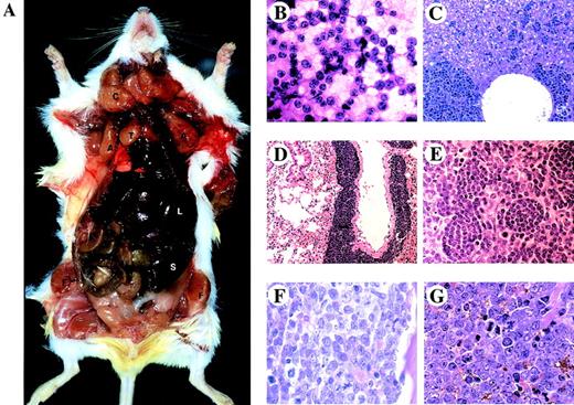Fig. 2. Gross pathology of Eμ-TEL/PDGFβR lymphoblastic lymphoma in the I line and microscopic histopathology of tumors and affected tissues from Eμ-TEL/PDGFβR mice. (A) Gross dissection of an affected I-line mouse shows enlargement of the liver (L), spleen (S), and thymus (T), as well as massive lymphadenopathy in the cervical (C), axillary (A), and femoral (F) node groups. (B) Touch preparation of the lymph node from an affected I-line mouse shows tumor composed of intermediate-sized lymphoid cells with scant cytoplasm, finely dispersed nuclear chromatin, and a brisk mitotic rate, features of lymphoblastic lymphoma. (C) Clusters of lymphoma cells present in hepatic sinusoids. (D) Lymphoma cells in N-line mouse with T-cell mediastinal lymphoma phenotype show involvement of the lung in peribronchial distribution. (E) Lymphoma cells from the same mouse as in D infiltrating the spleen, with some residual megakaryocytes and erythroid cells. (F) Bone marrow replacement by lymphoblasts in an N-line mouse with ALL phenotype. (G) Same N-line mouse as in F showing splenic involvement with lymphoblastic leukemia (H&E).