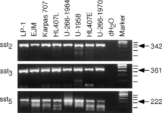 Fig. 2. Expression of sst2, sst3, and sst5 mRNA. RNA was extracted and cDNA was synthesized as described in Materials and Methods. Only RNA free of contaminating genomic DNA was used for the PCR. A PCR with 35 cycles of amplification was performed and the products were resolved on a 2% agarose gel and stained with ethidium bromide. dH2O was used as a control for carry-over contamination. The expected sizes of the fragments are: sst2, 342 bp; sst3, 361 bp; sst5, 222 bp.