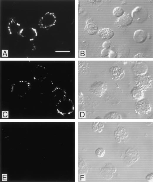 Fig. 5. Localization of PMN-binding phage clones by immunofluorescence. PMN isolated from peripheral blood were incubated with phage clones, fixed with paraformaldehyde, permeabilized with Triton X-100, and labeled with biotinylated polyclonal antibodies as described in Materials and Methods. There was a bright membrane staining after incubation with the FGPNLTGRW (A) or DLVTSKLQI (C) displaying phage. Incubation of PMN with an irrelevant phage resulted in no detectable immunofluorescence (E). Cytoplasmic staining suggestive of phage internalization was not detected. For orientation, the corresponding Nomarski images are shown in (B), (D), and (F). As can be seen, phage incubation labeled only part of the neutrophils. Incubation with the CKDGLFLGSWLC-displaying phage yielded staining patterns comparable with those found with the other PMN-binding phage (data not shown).