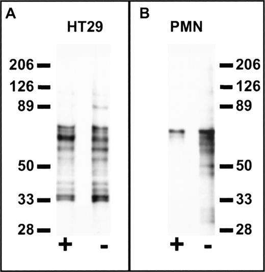 Fig. 8. Cell-specific labeling by a synthetic peptide derived from phage containing a PMN-binding peptide sequence. Suspensions of 1 × 107 HT29 epithelial cells (A) or PMN (B) in HBSS containing 0.5% BSA were incubated at 4°C for 1 hour in the presence (+) or absence (−) of 1 mmol/L FGPNLTGRW followed by the addition of Biotin-GF(Benzoyl)GPNLTGRW to a concentration of 100 μmol/L. After a 30-minute incubation in the dark, the samples were placed on ice and photolyzed for 10 minutes under UV light. The washed cell pellets were solubilized in 150 mmol/L NaCl, 100 mmol/L KCl, 2 mmol/L EDTA, and 10 mmol/L Hepes pH 7.4 containing 1% N-octylglucoside and the protease inhibitors DFP, PMSF, aprotinin, bestatin, chymostatin, and pepstatin. Cell lysates were then incubated with avidin-Sepharose for 2 hours followed by washing and denaturation of the avidin beads with reduced sodium dodecyl sulfate (SDS) sample buffer. Samples were subjected to SDS-polyacrylamide gel electrophoresis (PAGE) on 6% to 16% polyacrylamide gradient gels followed by western blot, probed with peroxidase-conjugated streptavidin, and developed by enhanced chemiluminescence (Amersham Inc). Each lane represents the biotin-labeled protein profiles of ∼3 × 106 cells. Molecular weights in kiloDaltons are shown to the side. As can be seen, specific labeling of PMN protein bands in the 30 to 60 kD range was inhibited by coincubation with unlabeled peptide, whereas no specific labeling is observed for HT29 cells.