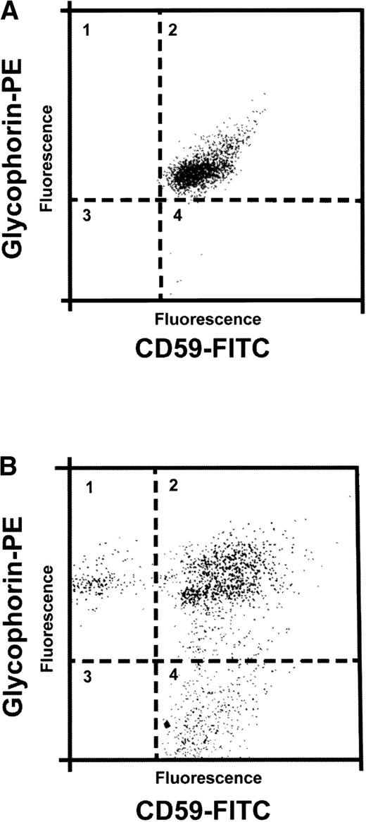 Fig. 8. Use of aerolysin to detect a minor population of PNH cells in patient with aplastic anemia. Two-color histogram of peripheral blood cells stained with MoAb directed against CD59 antigen (FITC) and MoAb directed against glycophorin-A (PE) before (A) and after (B) exposure to aerolysin (5 × 10−9 mol/L for 15 minutes). Axis represent log red (PE) or log green (FITC) fluorescence intensity.