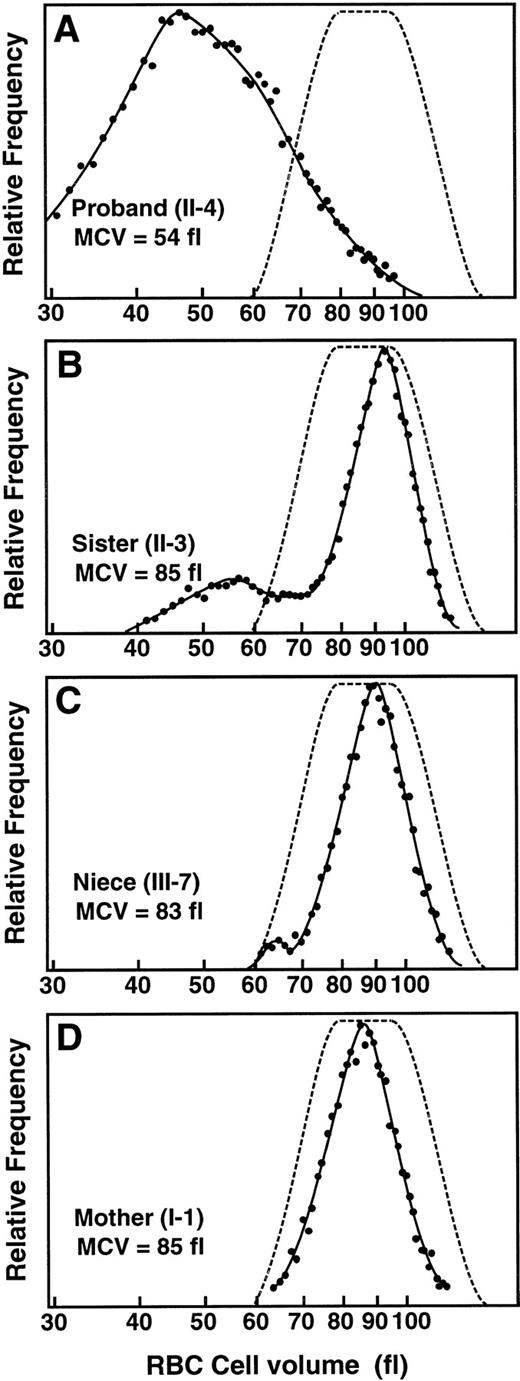 Fig. 2. Red blood cell (RBC) size distribution for family 6 hemizygous proband and heterozygotes. (—•—) Relative frequency of a particular RBC cell size (----); range of RBC size distributions of normal individuals. MCV is indicated for each individual. (A) Profile for family 6 proband II.4 (XLSA genotype and pedigree numbers are from Table 1). (B) Profile for the proband’s sister, II.3. (C) Profile for the proband’s niece, III.7. (D) Profile for proband’s mother, I.1.