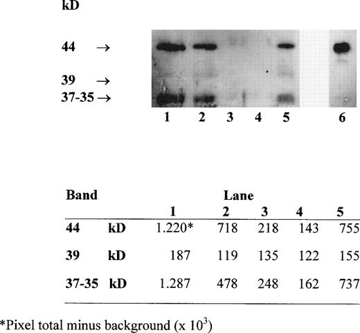 Fig. 2. Western blot analysis with MoAb TP25.99 of HLA class I heavy chains immunoprecipitated with MoAb W6/32 from RBC-30, RBC-5, W-RBC, LD-RBC, and PLT (lanes 1, 2, 3, 4, 5, respectively) and from PBMC lysate as control (lane 6). Densitometric analysis of the bands is shown in the lower panel.