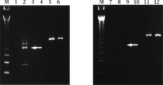 Fig. 1. Reverse transcriptase-polymerase chain reaction analysis of IL-12 p35 subunit mRNA expression by human mononuclear cells obtained from ICU patients. Specific fragments of IL-12 p35 were evident on Southern blotting (arrow), and upregulation was detected on day 8 in patients receiving cimetidine. Such fragments were not found in cells from patients treated with famotidine. Lanes 1 and 2 are cimetidine treatment on day 1 and day 8. Lanes 3 and 4 are negative controls for lanes 1 and 2, respectively. Lanes 5 and 6 are β-actin for lanes 1 and 2, respectively. Lanes 7 and 8 are famotidine treatment on day 1 and day 8. Lanes 9 and 10 are negative controls for lanes 7 and 8, respectively. Lanes 11 and 12 are β-actin for lanes 7 and 8, respectively. Lane M contains size markers of 123 bp.
