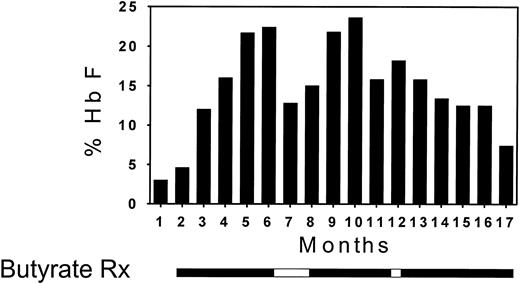Fig. 2. Bar graph illustrating the Hb F response in a patient receiving weekly butyrate therapy. Each vertical bar represents the average of approximately eight determinations of hemoglobin F per month. The periods of butyrate therapy are depicted as solid horizontal bars below the vertical bar graph and the periods of interruption of therapy are depicted as open horizontal bars.