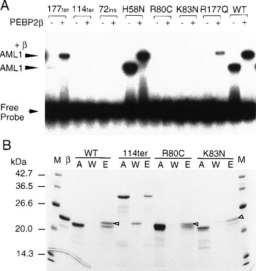 Fig. 3. Mutational alterations in the DNA binding and heterodimerization activities of the Runt domain. (A) The partial AML1 proteins indicated above the panel were produced in E coli and subjected to EMSA. Symbols + and − signify the presence and absence of the β2 subunit, respectively. (B) The indicated partial AML1 proteins were subjected to an affinity column assay. M, molecular weight marker; β, PEBP2β2; A, input AML1 protein; W, unbound proteins in washed fractions; E, bound proteins eluted at 250 mmol/L imidazole. The bands marked with open triangles indicate the β subunits associated with AML1 proteins.