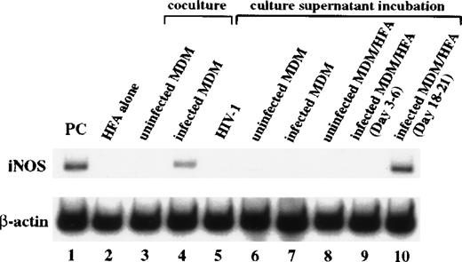 Fig. 3. Coculture supernatant induces iNOS in astrocytes. Total RNA was extracted from MDM/HFA cocultures at day 18 postinfection and from HFA cultures incubated for 7 days with different supernatants. Levels of iNOS mRNA in HFA were analyzed by RT-PCR. The cytokine-stimulated A172 cell line was used as a positive control. Lane 1, positive control; lane 2, HFA; lane 3, HFA cocultured with uninfected MDM; lane 4, HFA cocultured with infected MDM; lane 5, HFA incubated with HIV-1; lane 6, HFA incubated with day 18 to 21 supernatant of uninfected MDM culture; lane 7, HFA incubated with day 18 to 21 supernatant of infected MDM culture; lane 8, HFA incubated with day 18 to 21 supernatant of coculture with uninfected MDM and HFA; lane 9, HFA incubated with day 3 to 6 supernatant of coculture with infected MDM and HFA; lane 10, HFA incubated with day 18 to 21 supernatant of coculture with infected MDM and HFA.