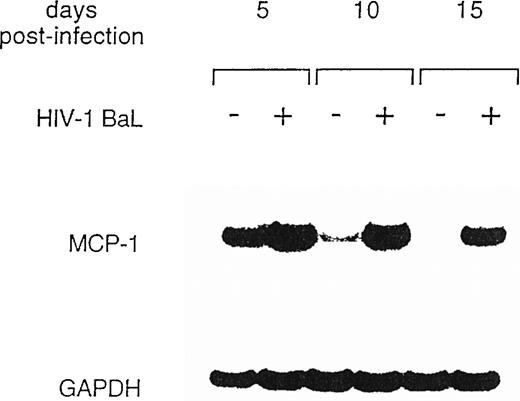Fig. 2. Expression of MCP-1 mRNA in MDM after HIV infection. MDM were infected with HIV-1 BaL (MOI: 0.1). Total RNA was extracted and MCP-1 expression was measured by RT-PCR at the indicated days postinfection. On normalization against GAPDH and given the arbitrary value of 1 to the MCP-1 mRNA of uninfected cultures after densitometric scanning (Molecular Dynamics, Sunnyvale, CA), RNA induction levels in HIV-infected MDM were 1.4 at day 5 and 12.4 at day 10, respectively. The results are representative of three independent experiments.