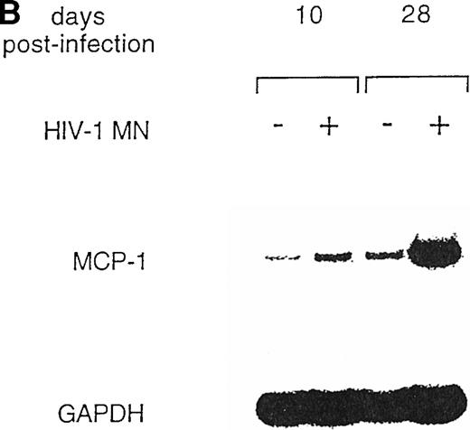 Fig. 4. HIV-1 MN infection of U937 promonocytic cells upregulates MCP-1. (A) MCP-1 protein levels and RT activity were measured at the indicated days postinfection. (B) MCP-1 expression measured by RT-PCR in uninfected and HIV-infected U937 cell cultures from which chemokine secretion was determined (A). RNA induction levels, calculated as described in the legend to Fig 2, were 1.5 at day 10 and 4.7 at day 28 postinfection, respectively.