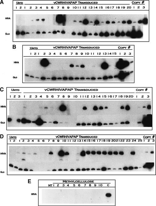 Fig. 2. Amplification of vCWRHIVAPAP sequences from individual LTC-IC colonies. CD34 cells were transduced with vCWRHIVAPAP at a functional MOI of 3 (particle MOI, 600) on day 0 and plated in long-term culture as described in Materials and Methods. Cells were harvested from stromal layers at designated time points, washed, and plated in methylcellulose with no G418 selection and colonies were plucked after 2 weeks. DNA was extracted and amplified for either the AAV vector using primers RPSP and DLASP or for β globin. β Globin served as a control for template integrity. The 418 HIVA band denotes the vector signal. The 268-bp Glo band denotes the β globin signal. Representative colonies from untransduced controls (Untd) are shown. Copy number controls are included in each analysis. For HIVA, the copy number corresponds to 12, 120, and 1,200 copies of the genome. For β globin, copy number controls show amplification from 80, 160, and 1,000 cells. (A) Week-5 LTC-ICs from donor TS. All colonies except one had intact DNA, albeit at varying quantities. The absence of a β globin signal from colony 9 indicated that the DNA template was inadequate. (B) Amplification of vCWRHIVAPAP sequences from individual week-8 LTC-IC colonies from donor TS. All colonies analyzed had intact DNA templates and 9 of 15 showed vector-specific signals. The standard curve is reversed in this experiment. (C) Amplification of vCWRHIVAPAP sequences of individual week-8 (transduced lanes 1 through 10) and week-10 (transduced lanes 11 through 20) LTC-IC colonies from donor HJ. Nine of 10 week-8 LTC-ICs had intact templates. Six of these showed vector-specific signals. All 10 week-10 colonies analyzed had intact DNA, and 6 of these were transduced. (D) Amplification of vCWRHIVAPAP sequences of individual week-5 and -10 LTC-IC colonies from donor FK. Colony 4 had intact albeit very low amounts of DNA as evidenced by a faint β globin signal on a prolonged radioautographic exposure. (E) Amplification of methylcellulose samples from between colonies in transduced LTC-IC wells. Ten separate samples of methylcellulose were amplified with primers RPSP and DLASP using PCR conditions identical to above. NT, no template; C, CWRHIVAPAP control (10 copies). This film was exposed for 36 hours longer than exposures in (A) through (D)