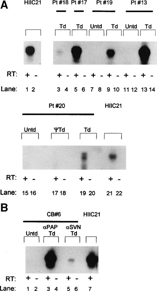 Fig. 4. Southern analysis of HIV antisense transcription from vCWRHIVASVN in transduced marrow and cord blood-derived hematopoietic progenitor cells after RT-PCR amplification. (A) RNA was extracted from week-5 to -7 LTBMCs and antisense sequences were reverse transcribed and amplified using primers 1a and 1b. The amplified products were resolved on a 1.2% agarose gel, transferred to nitrocellulose, and hybridized with an RSV LTR and antisense-specific probe. HIIC21, containing 1 copy of integrated vector per cell, served as the positive control. The 530-bp antisense transcript-specific product is shown. +RT and −RT refer to the presence or absence, respectively, of reverse transcription before amplification. The absence of signals in these lanes indicates that the antisense signals were RNA-specific. ψ, RT-PCR analysis of cells (donor 20) exposed to a sham stock of vector prepared in the absence of AAV rep and cap genes. Untransduced (Untd) cells from each donor tested served as negative controls. Td, transduced cultures. (B) HIV LTR antisense transcription in LTC-ICs initiated with CD34+CD38− cord blood cells 8 weeks after transduction. A representative sample, CB6, was transduced with vCWRHIVAPAP at MOI of 3 (particle MOI, 600) and vCWRHIVASVN at MOI of 0.1 (particle MOI, 50). Cells were harvested from 6 week LTBMCs, washed, and placed in colony-forming assays. RNA was extracted from colonies after 3 weeks, reverse transcribed, and amplified with primers 1a and 1b. The 530-bp antisense product was evident only after reverse transcription.