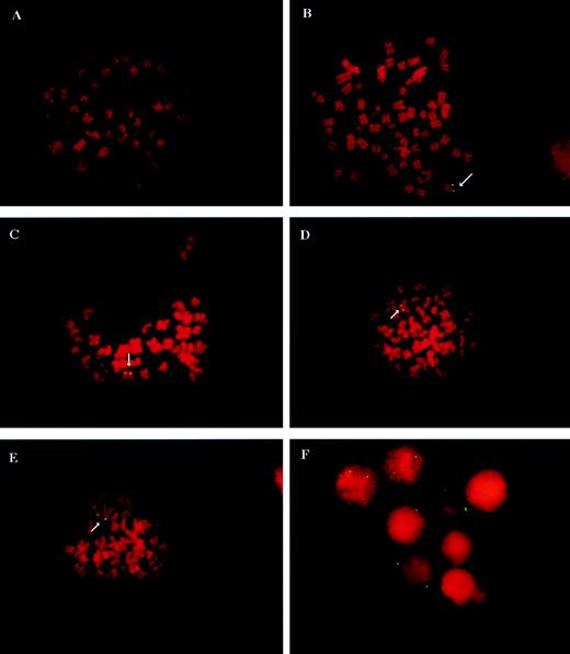 Fig. 3. FISH analysis of vCWRHIVAPAP transduced and untransduced cells. CD34 were transduced with vCWRHIVAPAP at a functional MOI of 3 (particle MOI, 600) and placed in culture as described above. Suspension cells were harvested at designated time points for analysis. (A) A metaphase spread from an untransduced CD34 culture showing no hybridization of the vector-specific probe to cellular sequences. (B) Hybridization analysis of HIIC21, a G418-resistant clonal 293-based cell line derived after transduction with vCWRHIVASVN. This clone carries 1 copy of the vector genome per cell (28) and served as a positive control. (C, D, and E) Representative metaphases from vCWRHIVAPAP transduced CD34 cultures at 5 weeks posttransduction. Note that vector-specific signals are observed on both sister chromatids. Signals were not digitally enhanced in this analysis. (F) Representative interphase nuclei from a vCWRHIVAPAP transduced CD34 culture 3 weeks posttransduction. Three nuclei with three or more signals, two nuclei with two signals each, and three nuclei with no signals are seen.
