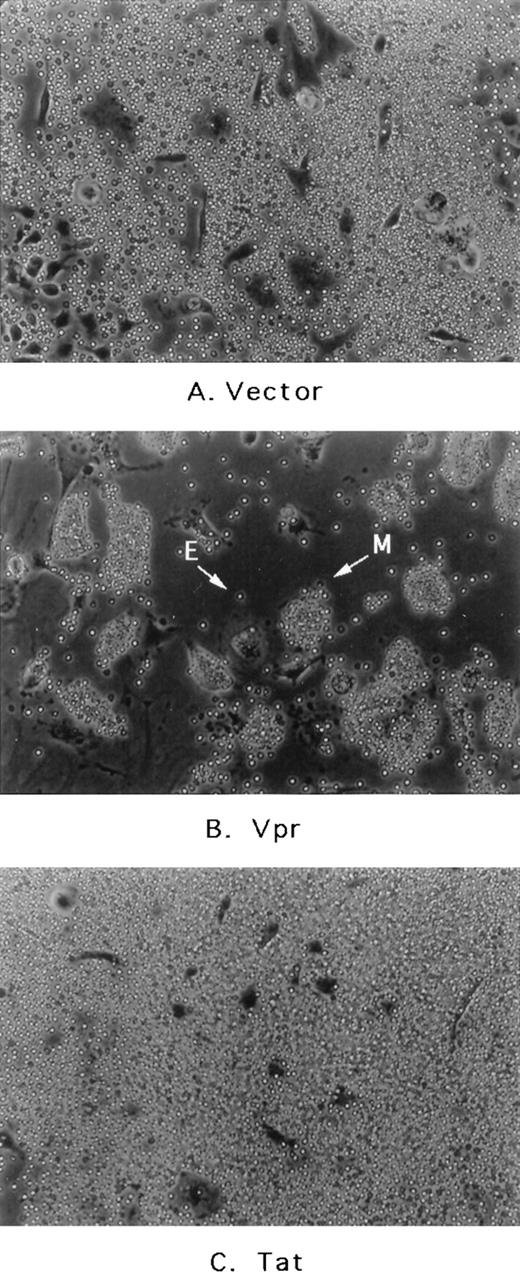 Fig. 2. Effect of transfected PA317 cell supernatants on murine marrow cultures propagated in vitro. (A) Media from PA317 cells transfected with vector alone or transfected with (B) vector with HIV-1 Vpr expression cassette or (C) vector with HIV-1 Tat expression cassette. E, free erythrocyte; M, erythrocyte-coated mononuclear phagocyte. The results shown are typical of at least three independent experiments.