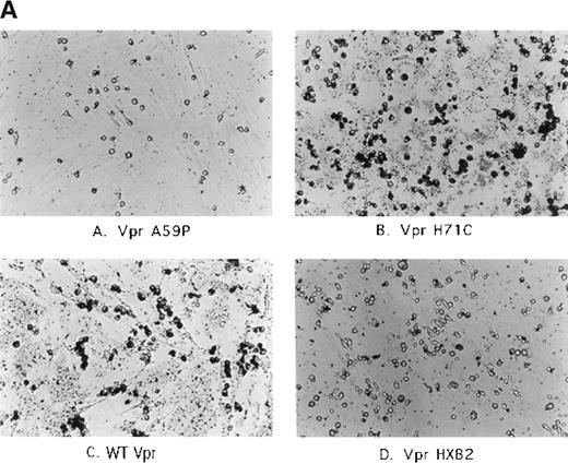Fig. 4. Effect of transfected PA317 cell supernatants on human marrow cultures propagated in vitro. Approximately 2 × 106 nucleated marrow cells were plated in D-MEM with heat-inactivated 20% FBS. Supernatants (1 mL) from PA317 cells transfected with SLX-CMV bearing expression cassettes for Vpr mutants, as indicated in the figure, were applied. (A) The following day, cells were washed with media and 200 μL of latex beads (Sigma; catalogue no. L-1398) were added directly to cultures replenished with media, and cultures were incubated at 37°C for an additional 30 minutes, washed with PBS, and photographed. Dark rounded cells are phagocytes ingesting deep-blue latex spheres. (B) More densely seeded cultures retaining large numbers of nonadherent cells were treated with PA317 supernatants as described above, except that no further additions were made. After 24 hours, cells were fixed with 100% methanol and photographed. The effects shown are typical of at least three independent experiments.
