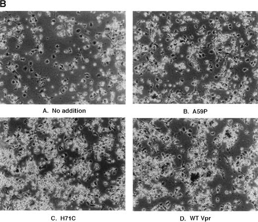Fig. 4. Effect of transfected PA317 cell supernatants on human marrow cultures propagated in vitro. Approximately 2 × 106 nucleated marrow cells were plated in D-MEM with heat-inactivated 20% FBS. Supernatants (1 mL) from PA317 cells transfected with SLX-CMV bearing expression cassettes for Vpr mutants, as indicated in the figure, were applied. (A) The following day, cells were washed with media and 200 μL of latex beads (Sigma; catalogue no. L-1398) were added directly to cultures replenished with media, and cultures were incubated at 37°C for an additional 30 minutes, washed with PBS, and photographed. Dark rounded cells are phagocytes ingesting deep-blue latex spheres. (B) More densely seeded cultures retaining large numbers of nonadherent cells were treated with PA317 supernatants as described above, except that no further additions were made. After 24 hours, cells were fixed with 100% methanol and photographed. The effects shown are typical of at least three independent experiments.