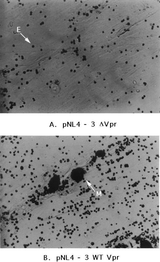 Fig. 5. Effect of HIV-1 infection on human marrow cultures. Human marrow cultures were infected with HIV-1 strains NL4-3 or NL4-3▵Vpr (Vpr deletion mutant). The microscope filter was adjusted to project nonadherent cells as light dense. E, free erythrocyte or granulocyte; M, mononuclear phagocyte coated with nonadherent cells.