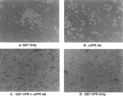 Fig. 7. Effect of GST-Vpr addition to human marrow cultures. Purified recombinant proteins were added directly to human marrow cultures propogated in vitro as indicated in the figure at a final concentration of approximately 3 nanomolar. Addition was performed in the absence or presence of rabbit polyclonal antisera directed against Vpr, as indicated in the figure, using 1 μL of antisera/mL of media.