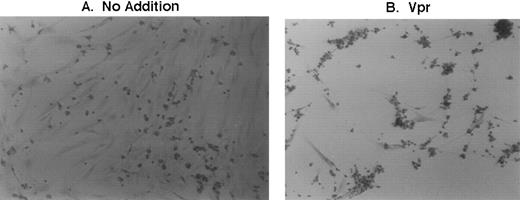 Fig. 8. Effect of recombinant Vpr addition to human marrow cultures. Purified recombinant Vpr proteolytically cleaved from the GST-Vpr chimera was added directly to cultures at a final concentration of approximately 3 nanomolar. Twenty-four hours later, untreated and treated cultures were washed with PBS and iron stain (Sigma) was applied to enhance cell morphology.