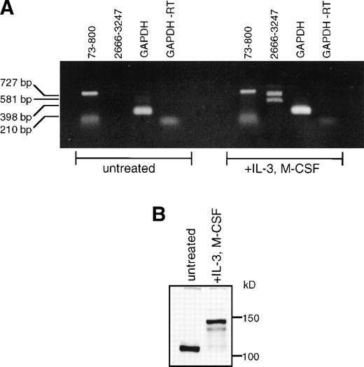 Fig. 3. SHIP expression in BM and BMM. (A) Murine BM was isolated and treated as described in Materials and Methods. Total RNA was purified from undifferentiated BM or from BMM. RT-PCR was performed using the primer sets shown in Fig 1A. (B) Untreated murine BMCs or BMM were lysed in NP-40 lysis buffer. Equal amounts (40 μg) of total protein were loaded into each lane of a 6% polyacrylamide gel. The gels were processed as described and protein was detected with the anti-SHIP polyclonal antibody #5340.