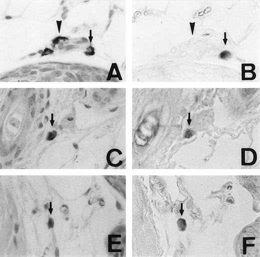 Fig. 1. Mast cells expressing MMCP-4 mRNA in the skin of +/+,mi/mi, and tg/tg mice. Serial sections from the skin of a +/+ mouse (A and B), a mi/mi mouse (C and D), and atg/tg mouse (E and F). A, C, and E, stained with alcian blue and nuclear fast red; B, D, and F, in situ hybridization with MMCP-4 probe. In each set of serial section, arrows show identical cells that expressed MMCP-4 gene and arrowheads show identical cells that did not express MMCP-4 gene. Original magnification ×400.