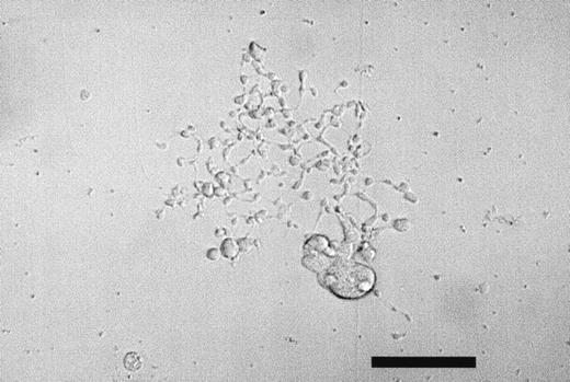 Fig. 2. Spontaneous proplatelet formation by megakaryocytes in methylcellulose culture medium. Peripheral blood CD34+cells were cultured with 10 ng/mL TPO and 10 ng/mL SCF in 35-mm plastic dishes. On day 9 of the culture, megakaryocytes with spontaneous proplatelet formation were observed under an inverted microscope (bar, 50 μm).