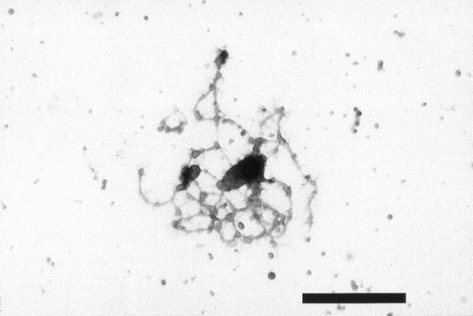 Fig. 6. Indirect immunostaining of human megakaryocytes with proplatelet formation. The collected megakaryocytes that were derived from peripheral blood CD34+ cells stimulated with 10 ng/mL TPO and 10 ng/mL SCF were incubated in the absence of antibodies in a 96-well tissue culture plate for 24 hours. After fixation, megakaryocytes were exposed to the anti-GP-IIb MoAb (5B12), followed by staining with biotinylated antimouse immunoglobulins and alkaline phosphatase-conjugated streptavidin. Megakaryocytes and proplatelets were stained with anti-GP-IIb MoAb (bar, 50 μm).