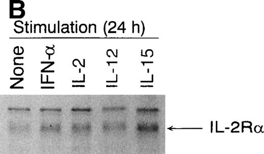 Fig. 1. (A) Induction of IL-2R, c-myc, andpim-1 gene expression by IFN-, IL-2, IL-12, and IL-15 in human T lymphocytes. T cells were stimulated with different cytokines for 3 hours, the cells were collected, and the total cellular RNA was isolated. RNA samples (20 μg) were size-fractionated on agarose gels, transferred to nylon membranes, and hybridized with specificIL-2R, c-myc, and pim-1 cDNA probes. EtBr-stained gel is shown to verify equal RNA loading. The result shown is from one experiment but is representative of three individual experiments. (B) Induction of IL-2R protein expression by IFN-, IL-2, IL-12, and IL-15. T cells were stimulated with different cytokines for 24 hours, and cell lysates were prepared. Proteins were separated on 10% SDS-PAGE, transferred to membranes, and immunoblotted with anti–IL-2R antibody.