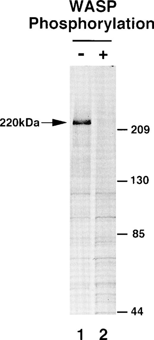 Fig. 4. Tyrosine-phosphorylation of WASP alters the association of a 220-kD cellular protein with WASP. WASP was expressed by cotransfection with Btk (K430R) (lane 1) or wild-type Btk (lane 2). Unphosphorylated (−) or phosphorylated (+) WASP proteins were immunopurified and then incubated with 35S-metabolically labeled RAMOS cell lysate. Labeled proteins bound to the beads were detected by autoradiography.
