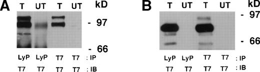 Fig. 6. Transfection of Lyp1 and Lyp2 cDNA. T7-tagged Lyp1 (A) and Lyp2 (B) were transfected into COS-7 cells and immunoprecipitated with anti-LyP or anti-T7 antibody and blotted with anti-T7. (A) Lyp1 transfection results in a transfected protein of 105 kD and a probable degradation product of 96 kD, whereas (B) shows LyP2 as a protein of 85 kD.