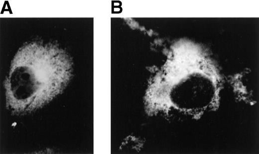 Fig. 7. Localization of Lyp1 and Lyp2 in transiently transfected COS-7 cells by immunofluorescence. COS-7 cells were transiently transfected with HA-tagged LyP1 and LyP2 cDNAs in pcDNA3 and immunofluorescent detection was performed with a monoclonal antibody against the HA tag (original magnification × 1,000). (A) Cells transfected with HA-Lyp2 cDNA. (B) Cells transfected with HA-LyP1 cDNA.