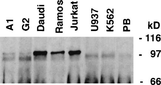 Fig. 8. Lyp protein expression in lymphoid and myeloid cell lines. Lyp was immunoprecipitated from cell lines (107cells) and blotted with Lyp antibodies. A protein band of 105 kD corresponding to LyP1 could be detected in Jurkat, Daudi, Ramos, A1, and G2 cells, whereas U937 and K562 do not appear to have detectable amounts of Lyp. (PB), preimmune serum control.