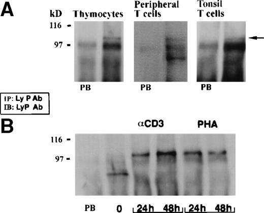 Fig. 9. Expression of Lyp proteins in resting and activated T cells. (A) Lyp was precipitated from thymocytes (80 × 106cells), peripheral blood T cells (25 × 106 cells), and tonsil T cells (10 × 106 cells) and immunoblotted with anti-Lyp. Preimmune serum controls (PB) are presented in each case. A band of 105 kD is present in each sample and a band of 85 kD can be seen only in resting peripheral T cells. (B) Lyp was immunoprecipitated from peripheral blood T cells (25 × 106 cells) before and after stimulation with anti-CD3 (2.5 μg/mL) or PHA over a period of 48 hours. There is increased 105-kD Lyp1 expresssion, whereas the 85-kD protein appears to be downregulated.