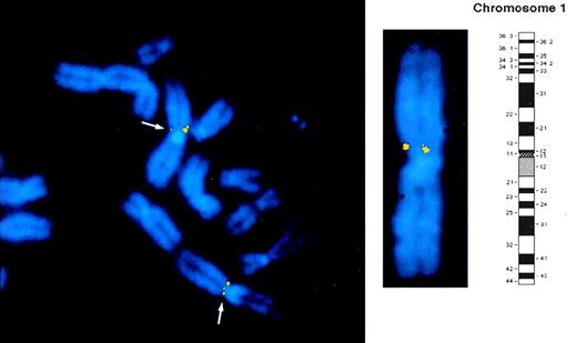 Fig. 3. Regional mapping of the Lyp gene by FISH to normal human lymphocyte chromosomes counterstained with DAPI. Biotinylated cDNA probe was detected with avidin-FITC. Separate images of DAPI counterstained metaphase chromosomes and of LyP cDNA probe hybridization signals were captured and overlaid electronically as described in Materials and Methods. Part of a representative metaphase preparation is shown to indicate the position of the Lyp probe FISH signals that are visible as two yellow fluorescent spots on the p arm of chromosome 1. A DAPI banded chromosome 1 together with schematic ideogram is shown to indicate that the Lyp1 probe hybridizes to band 1p13.