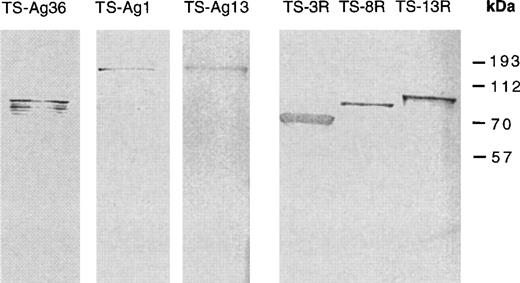 Fig. 1. Identification of chimeric trans-sialidases. Detection of chimeric trans-sialidases in Western blot was performed with antisera raised in mice against each repetitive T. cruzi antigen expressed in pGEX vector. The monoclonal antibody against SAPA-repeats used to probe TS-3R, TS-8R, and TS-13R proteins has been already described.25 The presence of additional immunoreactive bands in TS-Ag 36 protein is due to partial protein degradation. The increase in the apparent molecular weight of TS-Ag 13 protein is attributed to abnormal migration in SDS-PAGE. Molecular weight markers are indicated in kD.