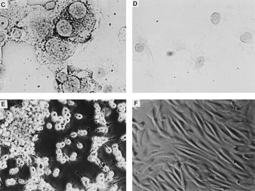 Fig. 1. Retroviral vectors and packaging cell lines. (A) LK; (B) LN-ras2. LTR, M-MLV long terminal repeat; Ψ, packaging region; thick vertical line, viral splice donor site; parallel vertical lines, polylinker; arrows, primers used for PCR. (C and D) Immunohistochemical staining for human N-ras protein. (C) ΨLN-ras215 cells show cytoplasmic staining of N-ras protein. (D) ΨLN-ras2 nonproducers (LN-ras2 transfectant that did not make detectable virus). Mophology of (E), ΨLN-ras215 producers; (F) ΨLK09 producers (original magnification ×250).