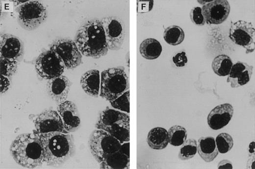 Fig. 4. Altered differentiation of LN-ras2–transduced BM cells. (A through D) FACS analysis of transduced BM cells after 27 days in liquid culture. (A) LK cells stained with Mac-1 antibody (macrophage specific). (B) LK cells stained with Gr-1 (granulocyte specific). Underlayed (open curves represent isotype controls). (C) LN-ras2 cells stained with Mac-1. (D) LN-ras2 cells stained with Gr-1. (E and F) Cytocentrifuge preparations stained with May-Grunwald and Giemsa showing morphologic appearance of methylcellulose colonies after 7 days in liquid culture. View shows representative cells from pooled colonies from LK (E) and LN-ras2 (F) cultures (original magnification ×500).