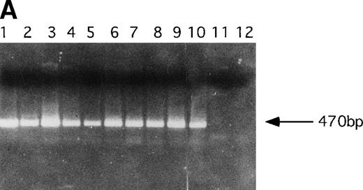Fig. 5. Molecular analysis of reconstituted mice. (A) Proviral integrants. Ethidium bromide-stained agarose gel showing PCR products amplified from lysates of cells from reconstituted mice or BM cultures. Primers 1 and 2 (Fig 1) were used for amplification of LN-ras2 sequence. Lane 1, ΨLN-ras215 (positive control); lane 2, Nr1 spleen; lane 3, Nr4 thymus; lane 4, Nr5 spleen; lane 5, Nr7 spleen; lane 6, Nr7 lung; lane 7, Nr8 lung; lane 8, Nr8 spleen; lane 9, Nr9 lung; lane 10, LN-ras2–infected BM (in vitro analysis); lane 11, negative control DNA; lane 12, no sample. (B) Proviral expression. Autoradiograph of a Northern blot hybridized to a Ψ region probe (described in Materials and Methods). RNA samples are indicated above each well. Transcript sizes are indicated to the right. The RNA samples on ethidium bromide-stained agarose gels are shown below the autoradiograph. Lane numbers above the gel correspond to the autoradiograph.