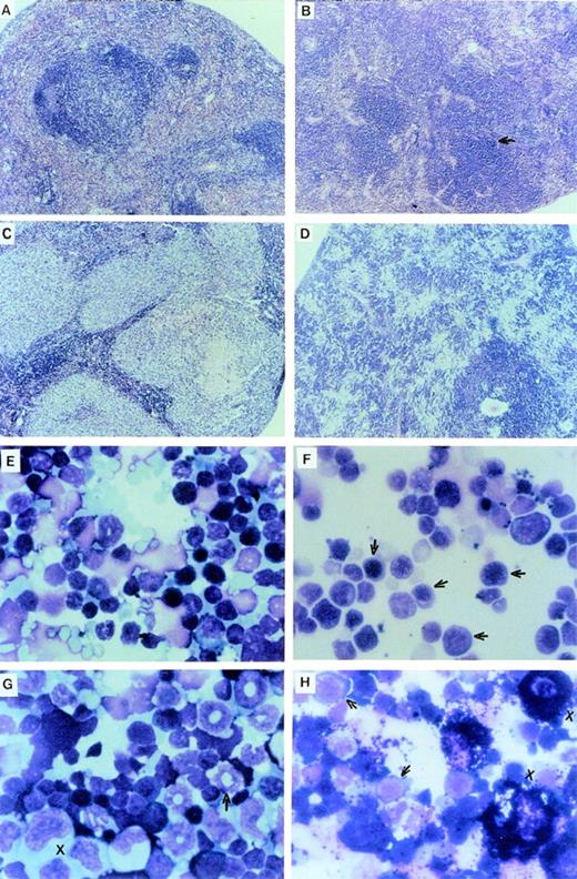 Fig. 2. Proliferative disorders in LN-ras2 reconstituted mice. (A) LK8 spleen section. Normal splenic architecture, follicular organization of the lymphoid cells, marginal zones, and red pulp composed of erythroid cells are shown. (B) Nr9 spleen section. The splenic architecture is disrupted by darkly stained hematopoietic cells (arrow). (C) Nr18 spleen section. Large foci of myelomonocytic cells that obliterate the normal splenic architecture (light staining) are shown. (D) Nr17 spleen section. Sheets of abnormal mast cells (light staining) that have disrupted the normal splenic architecture are shown. (E) LK8 spleen cells. Normal splenocytes, large and small lymphocytes, myeloid cells, and erythroid progenitor cells are shown. (F) Nr9 spleen cells. Abundant erythroid progenitors (arrows) are shown. (G) Nr16 spleen cells. Increased numbers of large monocytes (X) and myeloid cells (arrow) are shown. (H) Nr17 spleen cells. Darkly granulated mast cells (X) and increased numbers of erythroid progenitors (arrows) are shown. (I) LK8 blood. Normal erythrocytes and a neutrophilic granulocyte are shown. (J) Nr9 blood. Polychromatic and spiculated erythrocytes are demonstrated. (K) Nr18 blood. Two abnormal myelomonocytic cells are shown. (L) Blood from Nr17. Aberrant erythrocytes are shown. Histologic sections (A through D) were stained with hematoxylin and eosin (original magnification ×50). Cytospun preparations (E through H) and blood smears (I through L) were stained with May-Grunwald and Giemsa (original magnification ×500).