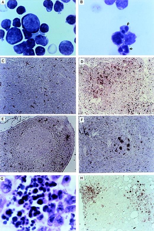 Fig. 3. Apoptosis in LN-ras2 reconstituted mice. (A) LK3 thymocytes demonstrate normal morphology. (B) Nr9 thymocytes have condensed and fragmented nuclei (arrows). (C) LK2 TUNEL-stained thymus section. Small numbers of apoptotic cells (stained red) dispersed throughout the cortex are shown. (D) Nr9 TUNEL-stained thymus section. An elevation of apoptotic cells is shown. (E) LK3 TUNEL-stained spleen section. Small numbers of apoptotic cells are dispersed throughout the spleen. (F) Nr9 TUNEL-stained spleen section. Apoptotic cells clustered within lymphoid follicles are shown. (G) Spleen section from Nr9 showing morphology of apoptotic cells. (H) Nr16 TUNEL-stained section of intestinal node. Cytospun preparations (A and B) were stained with May-Grunwald and Giemsa (original magnification ×1,250). Tissue section (G) was stained with hematoxylin and eosin (original magnification ×1,250). TUNEL-stained tissue sections (C through F and H) apoptotic cells are stained red (original magnification ×125).