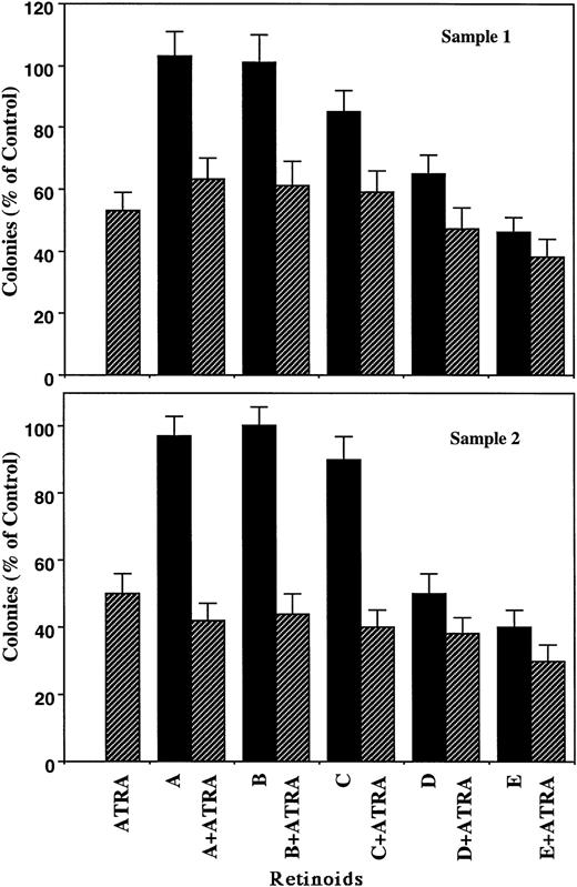 Fig. 2. Effects of retinoids (10-7 mol/L) on clonal proliferation of fresh APL cells. Samples from two patients were analyzed and shown in upper and lower panels. Results are expressed as the percentage of control plates not exposed to retinoids. Data represent mean ± SD of triplicate cultures.