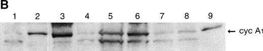 Fig. 2. Northern blot and immunoblot showing cyclin A1 expression in leukemia samples. (A) Northern blot showing the expression of cyclin A1 in leukemia samples. Lanes 26 and 27 are NB4 and U937 cell lines, respectively. (B) Immunoblot show cyclin A1 protein level in leukemia samples. The diagnostic information for each lane of the Northern blot and immunoblot is summarized in Table 2.